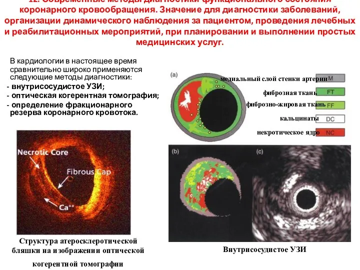 12. Современные методы диагностики функционального состояния коронарного кровообращения. Значение для