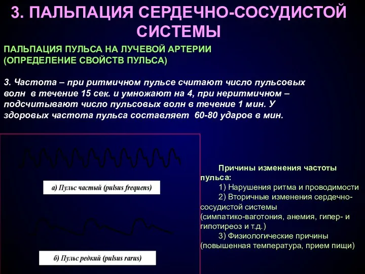 3. ПАЛЬПАЦИЯ СЕРДЕЧНО-СОСУДИСТОЙ СИСТЕМЫ ПАЛЬПАЦИЯ ПУЛЬСА НА ЛУЧЕВОЙ АРТЕРИИ (ОПРЕДЕЛЕНИЕ