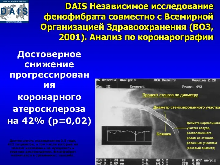 DAIS Независимое исследование фенофибрата совместно с Всемирной Организацией Здравоохранения (ВОЗ,