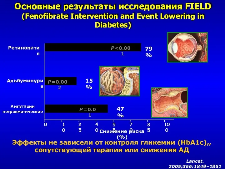 Снижение риска (%) 0 10 25 40 55 70 85