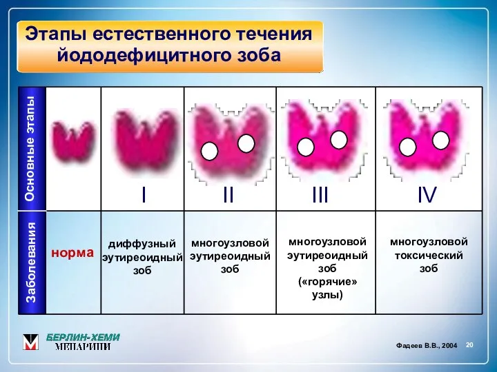 20 Фадеев В.В., 2004 Основные этапы I II III IV