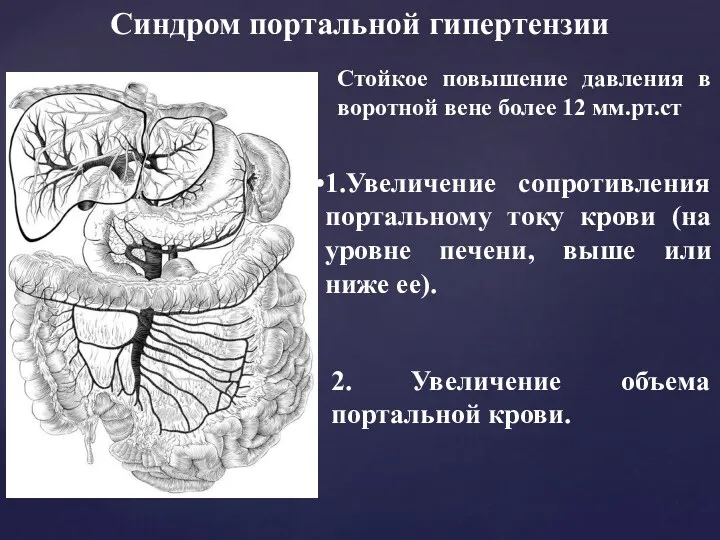 Синдром портальной гипертензии Стойкое повышение давления в воротной вене более