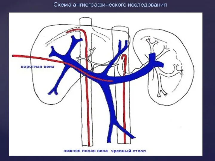 Схема ангиографического исследования