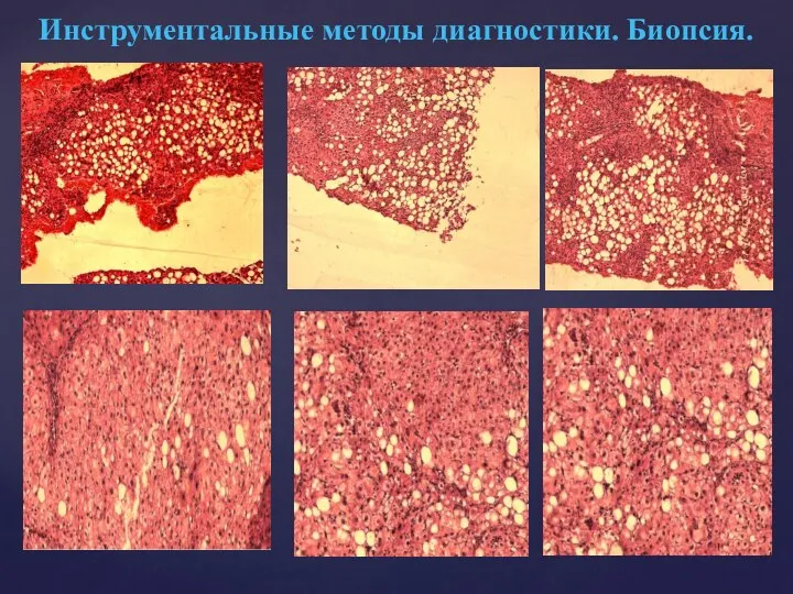 Инструментальные методы диагностики. Биопсия.