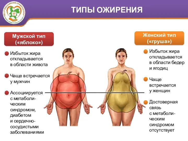 Избыток жира откладывается в области живота Чаще встречается у мужчин