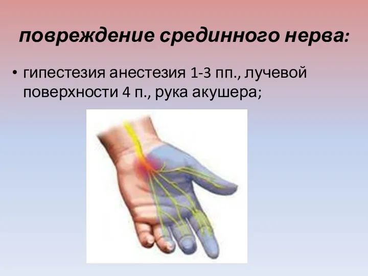 повреждение срединного нерва: гипестезия анестезия 1-3 пп., лучевой поверхности 4 п., рука акушера;