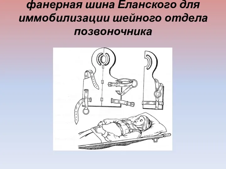 фанерная шина Еланского для иммобилизации шейного отдела позвоночника