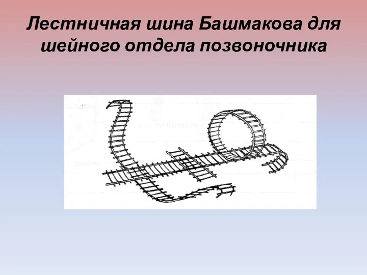 Лестничная шина Башмакова для шейного отдела позвоночника