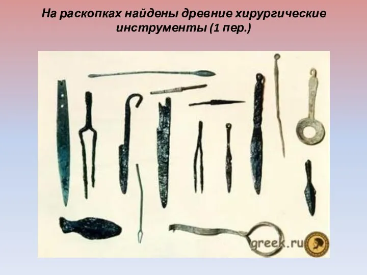 На раскопках найдены древние хирургические инструменты (1 пер.)