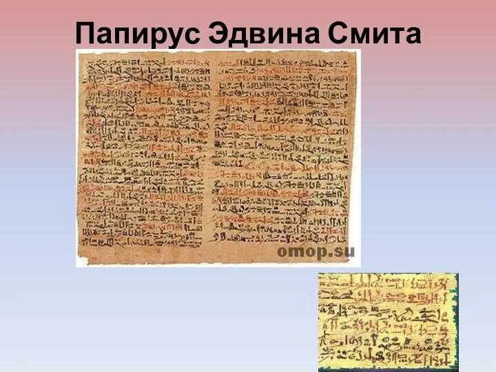 Папирус Эдвина Смита