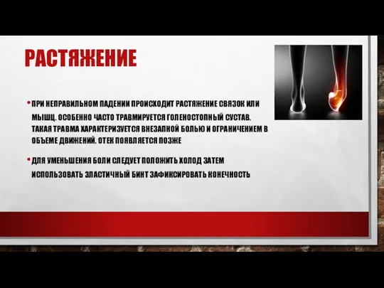 РАСТЯЖЕНИЕ ПРИ НЕПРАВИЛЬНОМ ПАДЕНИИ ПРОИСХОДИТ РАСТЯЖЕНИЕ СВЯЗОК ИЛИ МЫШЦ. ОСОБЕННО