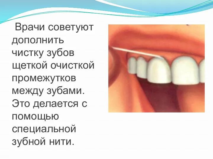 Врачи советуют дополнить чистку зубов щеткой очисткой промежутков между зубами.