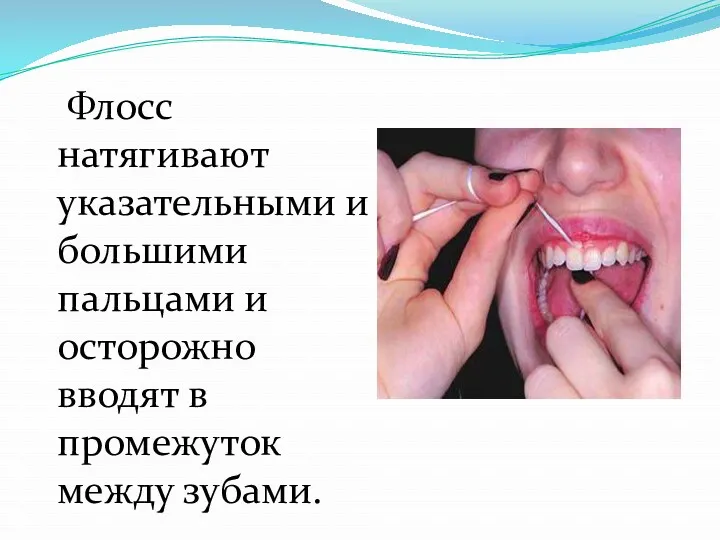 Флосс натягивают указательными и большими пальцами и осторожно вводят в промежуток между зубами.