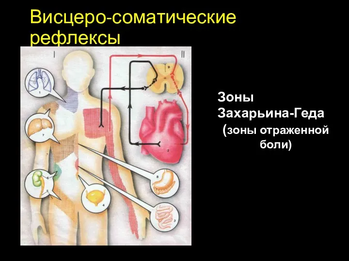 Висцеро-соматические рефлексы Зоны Захарьина-Геда (зоны отраженной боли)