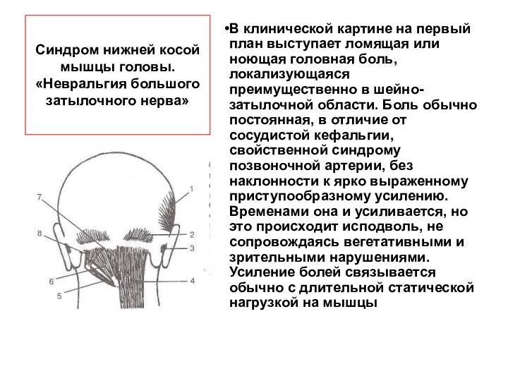 Синдром нижней косой мышцы головы. «Невральгия большого затылочного нерва» В клинической картине на