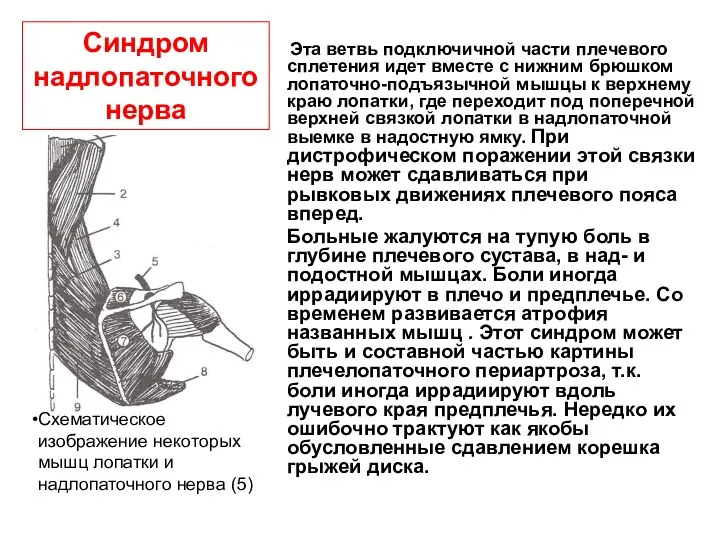 Синдром надлопаточного нерва Эта ветвь подключичной части плечевого сплетения идет