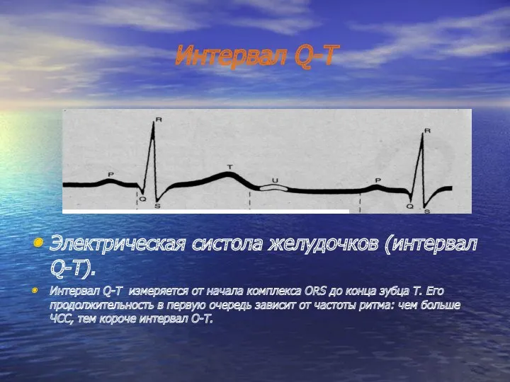 Интервал Q-T Электрическая систола желудочков (интервал Q-T). Интервал Q-T измеряется