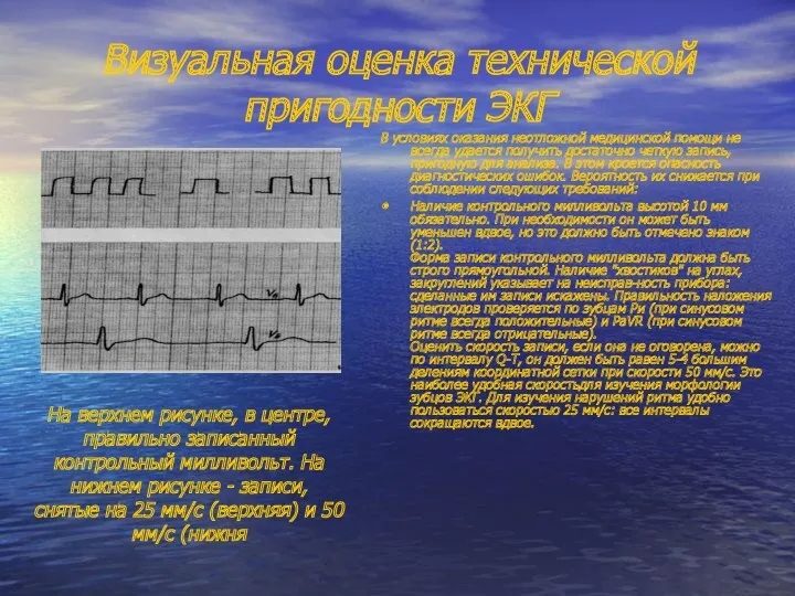 Визуальная оценка технической пригодности ЭКГ В условиях оказания неотложной медицинской