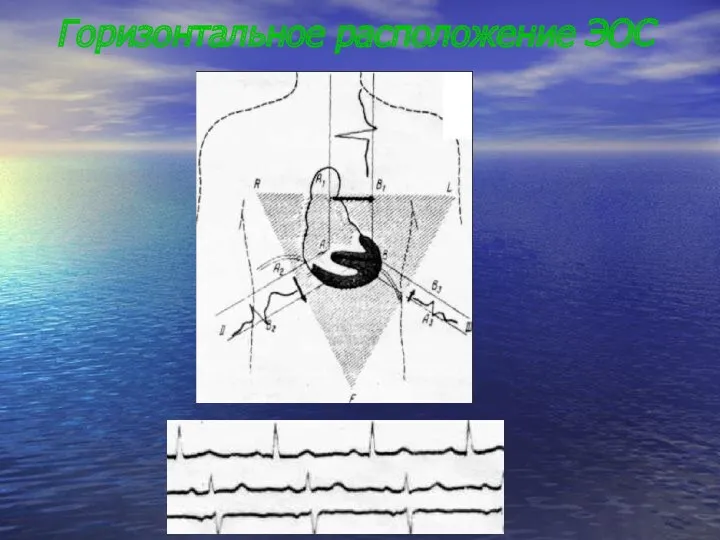 Горизонтальное расположение ЭОС