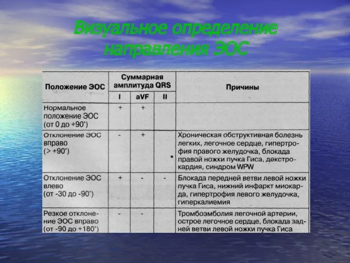 Визуальное определение направления ЭОС