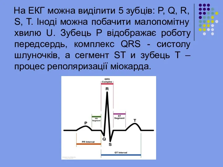 На ЕКГ можна виділити 5 зубців: P, Q, R, S,