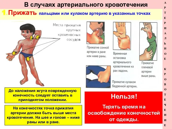В случаях артериального кровотечения 1. Прижать пальцами или кулаком артерию в указанных точках