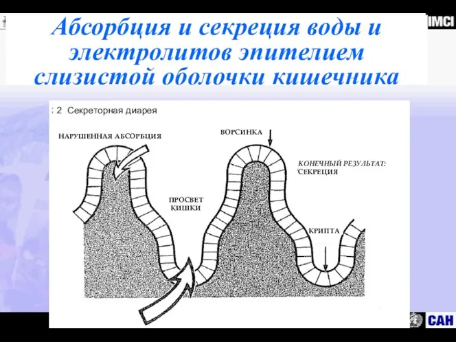 Абсорбция и секреция воды и электролитов эпителием слизистой оболочки кишечника 2 Секреторная диарея