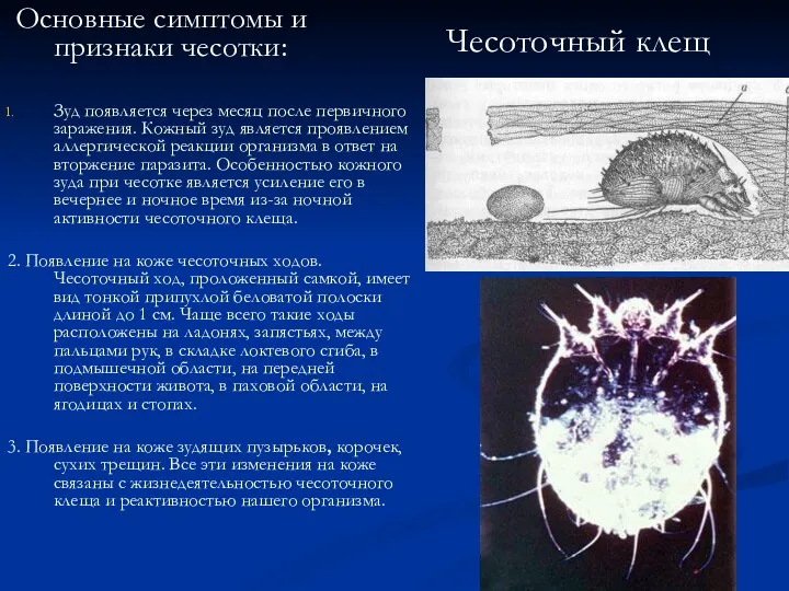 Чесоточный клещ Основные симптомы и признаки чесотки: Зуд появляется через