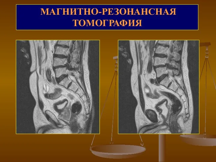 МАГНИТНО-РЕЗОНАНСНАЯ ТОМОГРАФИЯ