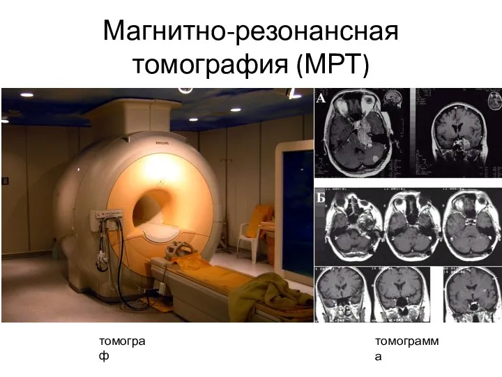 Магнитно-резонансная томография (МРТ) томограф томограмма