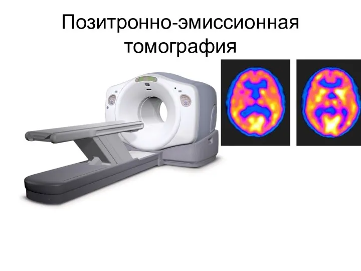 Позитронно-эмиссионная томография