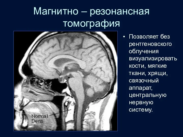 Магнитно – резонансная томография Позволяет без рентгеновского облучения визуализировать кости,