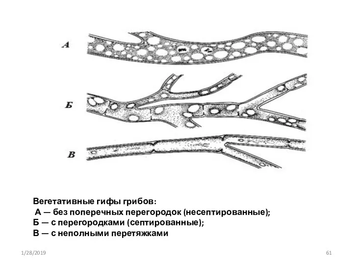 Вегетативные гифы грибов: А — без поперечных перегородок (несептированные); Б — с перегородками
