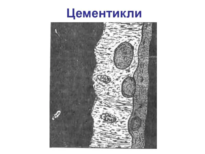 Цементикли