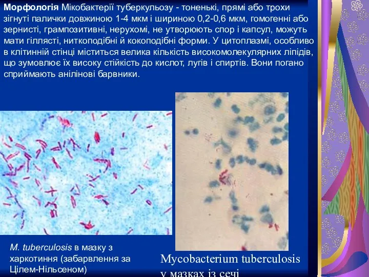 Mycobacterium tuberculosis у мазках із сечі M. tuberculosis в мазку