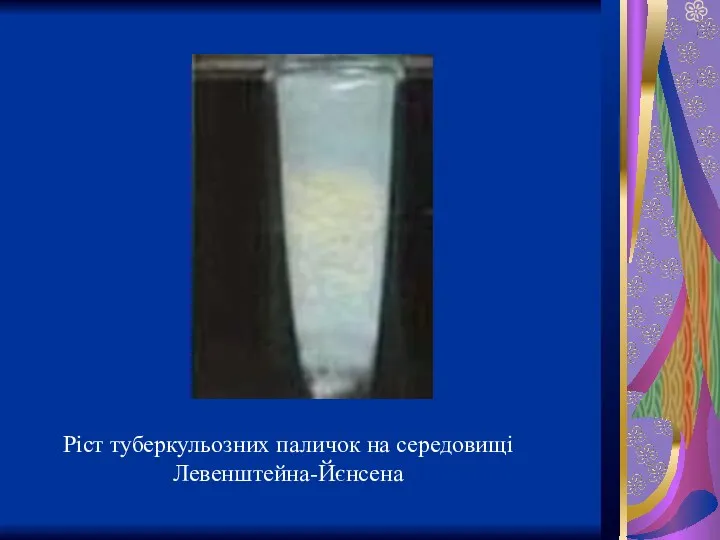 Ріст туберкульозних паличок на середовищі Левенштейна-Йєнсена