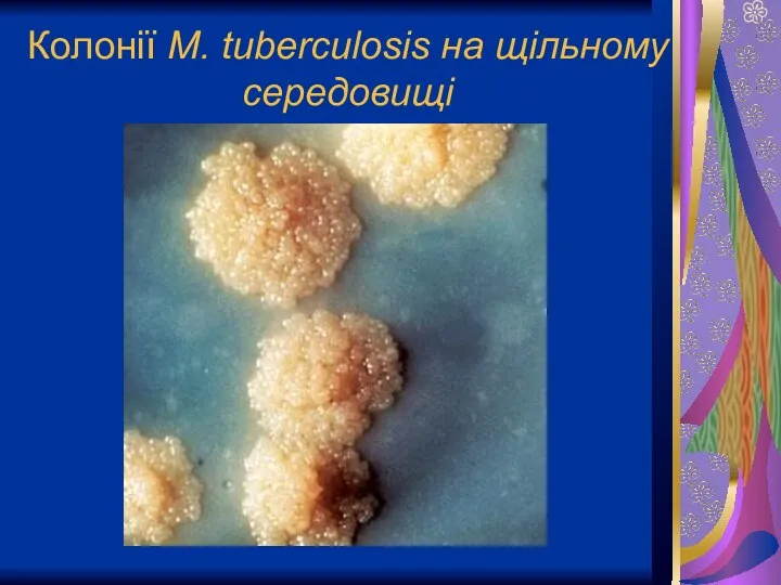 Колонії M. tuberculosis на щільному середовищі