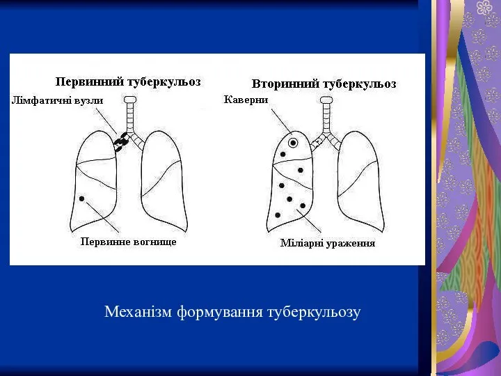 Механізм формування туберкульозу