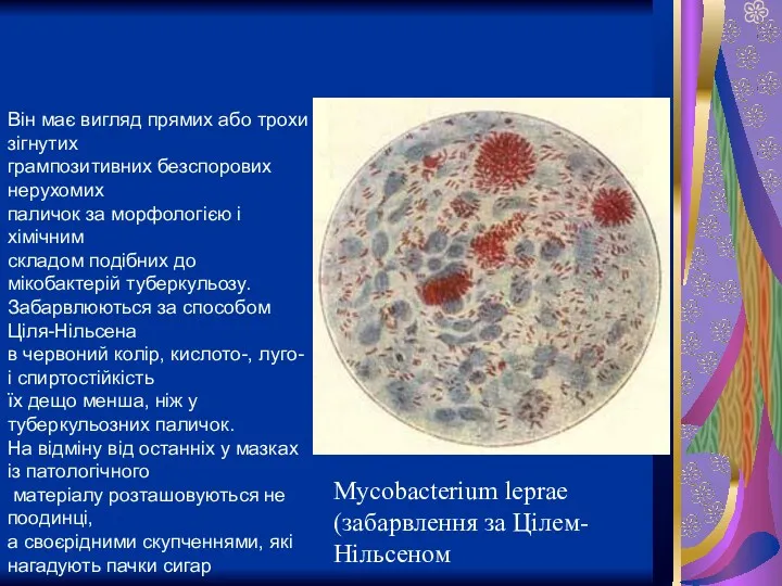 Mycobacterium leprae (забарвлення за Цілем-Нільсеном Він має вигляд прямих або