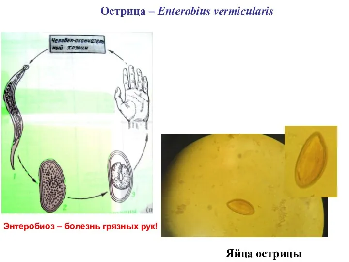 Острица – Enterobius vermicularis Яйца острицы Энтеробиоз – болезнь грязных рук!