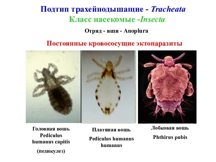 Подтип трахейнодышащие - Tracheata Класс насекомые -Insecta Отряд - вши
