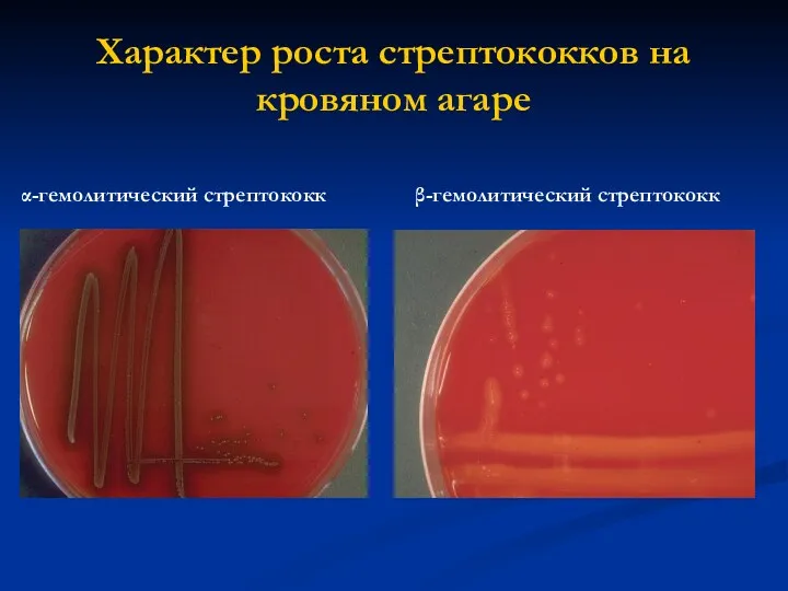 Характер роста стрептококков на кровяном агаре α-гемолитический стрептококк β-гемолитический стрептококк