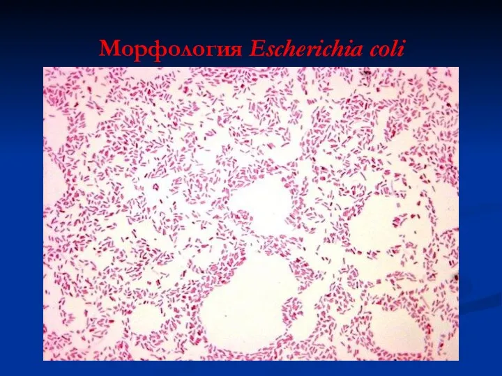 Морфология Escherichia coli