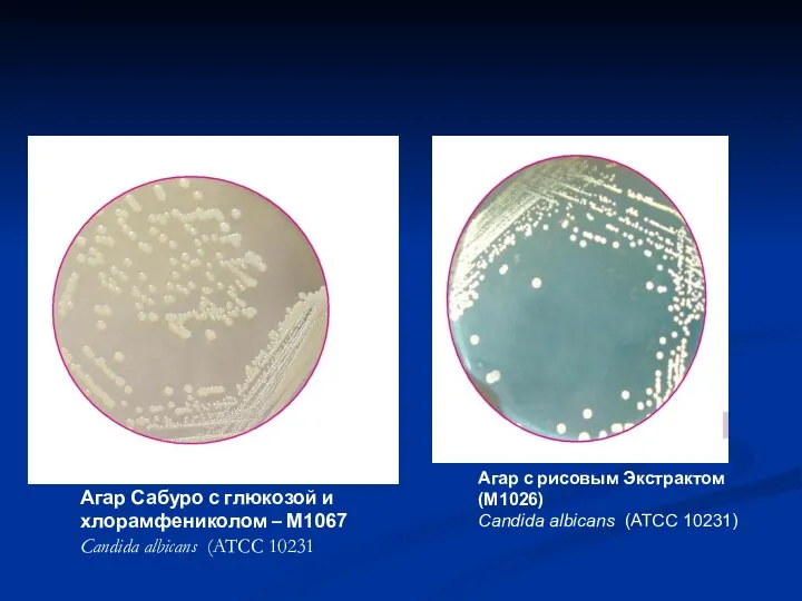 Агар Сабуро с глюкозой и хлорамфениколом – M1067 Candida albicans