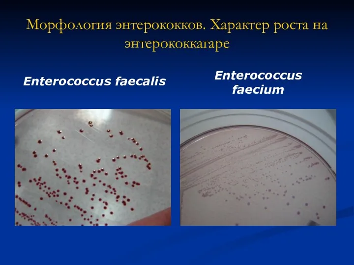 Морфология энтерококков. Характер роста на энтерококкагаре Enterococcus faecalis Enterococcus faecium