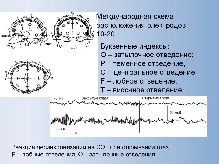 Международная схема расположения электродов 10-20 Буквенные индексы: О – затылочное