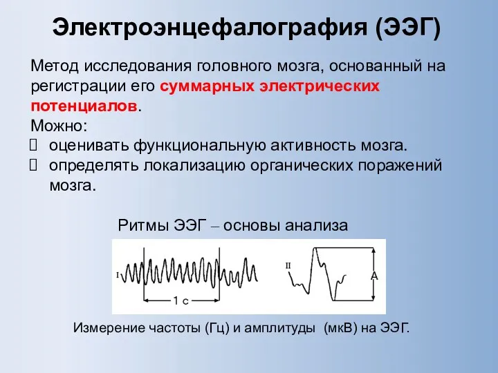 Электроэнцефалография (ЭЭГ) Метод исследования головного мозга, основанный на регистрации его