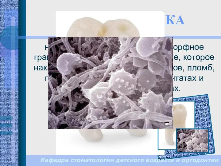 ЗУБНАЯ БЛЯШКА неминерализованное мягкое аморфное гранулированное зубное отложение, которое накапливается