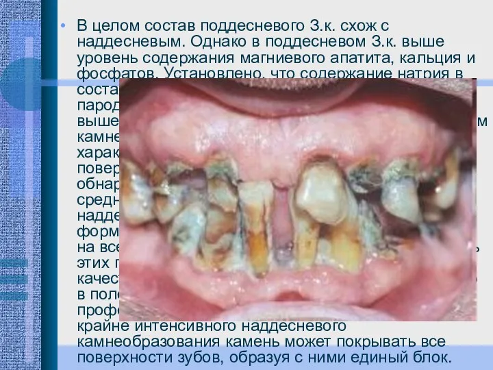 В целом состав поддесневого З.к. схож с наддесневым. Однако в