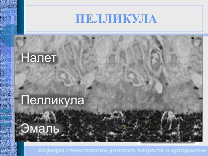 ПЕЛЛИКУЛА тонкая органическая пленка, которая образуется из гликопротеидов слюны на